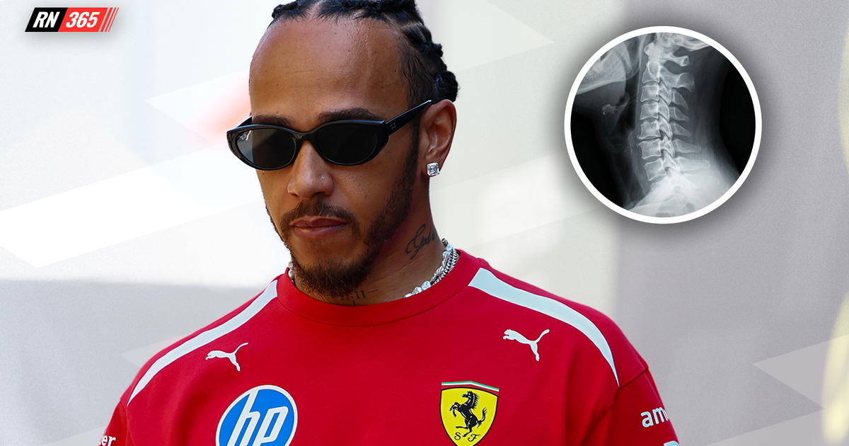 Lewis Hamilton reveals secret injury as Mercedes introduce team orders thumbnail